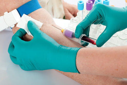 How Much Does a Private Blood Test Cost in the UK?
